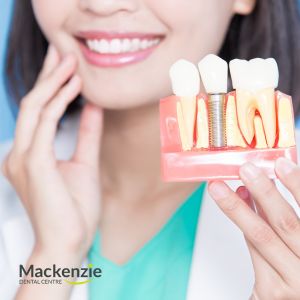 dental implants vaughan