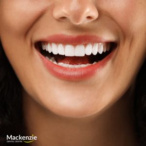 veneers dentist vaughan