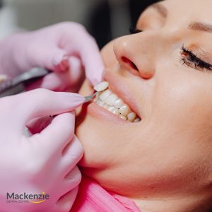 How a Dentist in Vaughan Can Tailor Veneers to Match Your Unique Smile